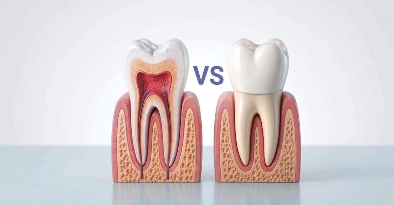 root canal vs crown 2